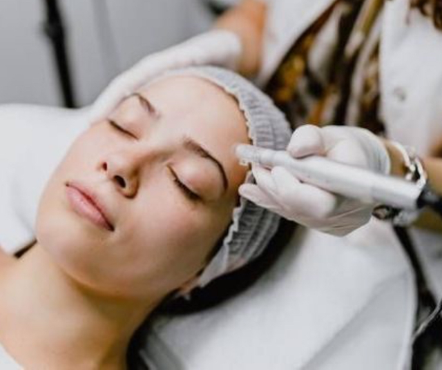 Soin Micronneedling 