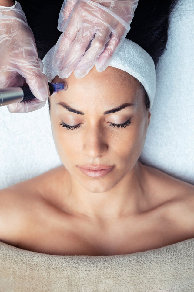 FORMATION MICRONEEDLING VISAGE 