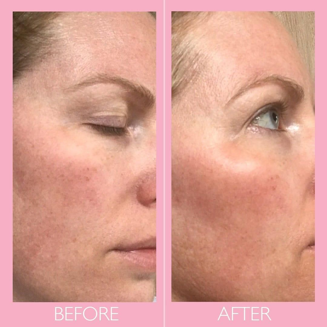 Skinician Bespoke Facial 