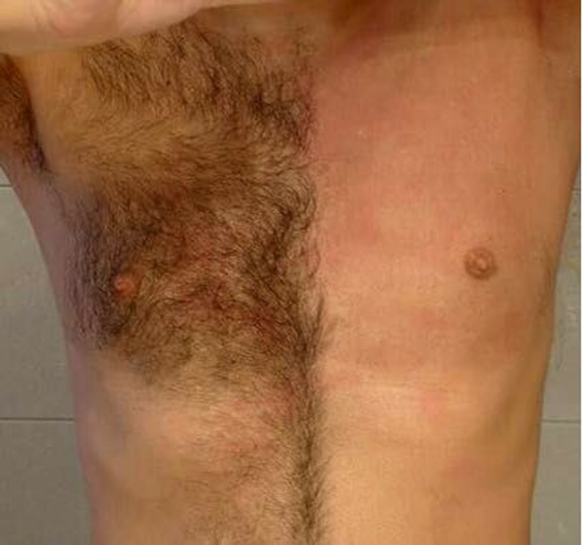 Épilations Torse ou Ventre.