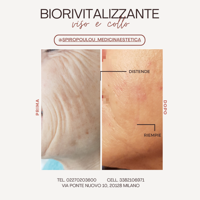 Biorivitalizzante