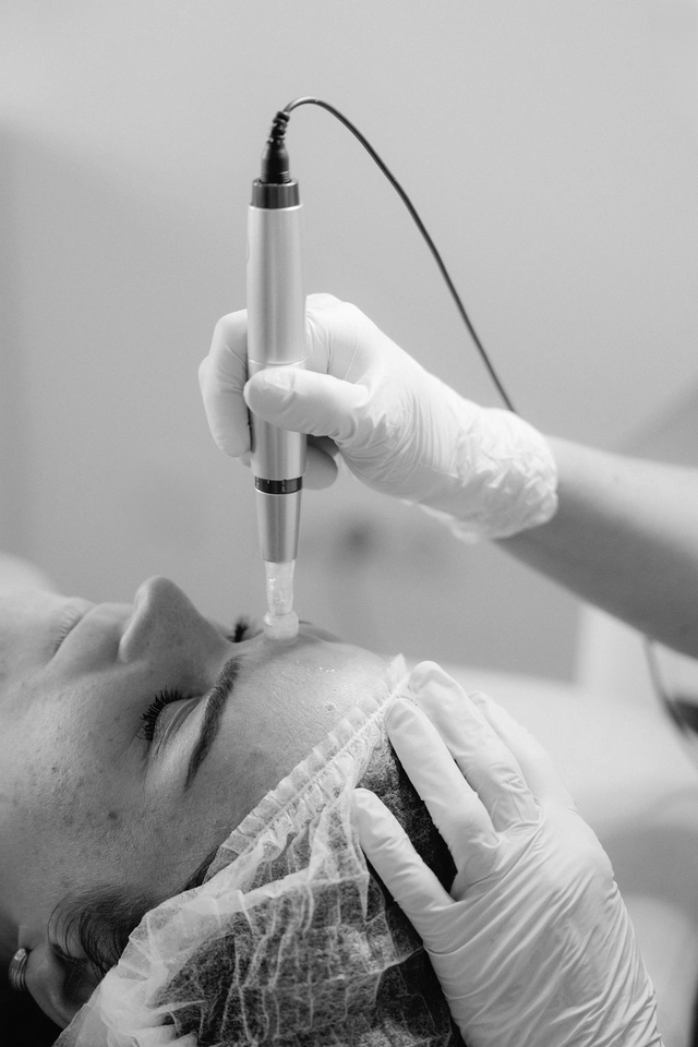 Microneedling in Bonn - Geschenk Gutschein