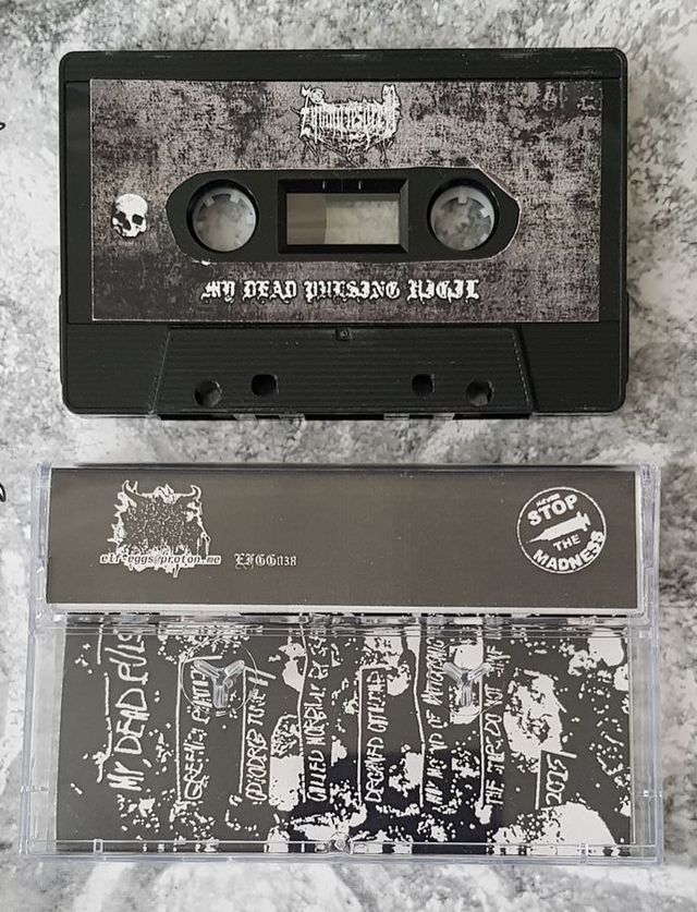 ZKYWBREZDREB My Dead Pulsing Vigil MC