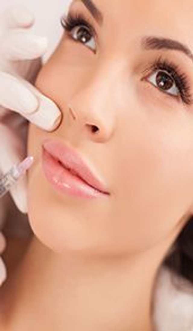 Lip lines/Smoker's lines 