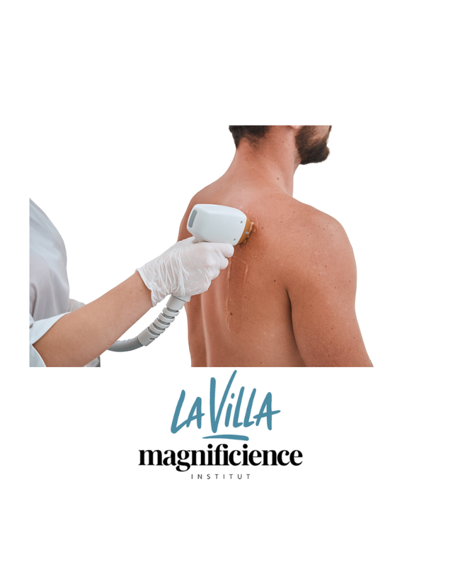 Epilation définitive homme