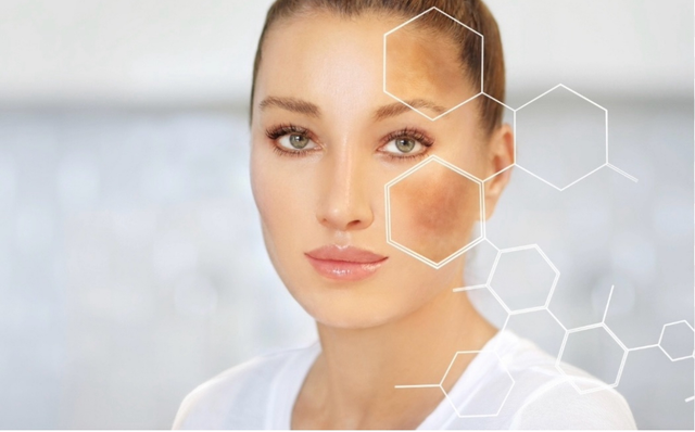 MICRONEEDLING Radiance antimacchie