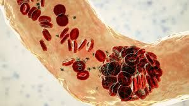 Estudio genético trombofilia