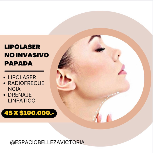Papada tratamiento 