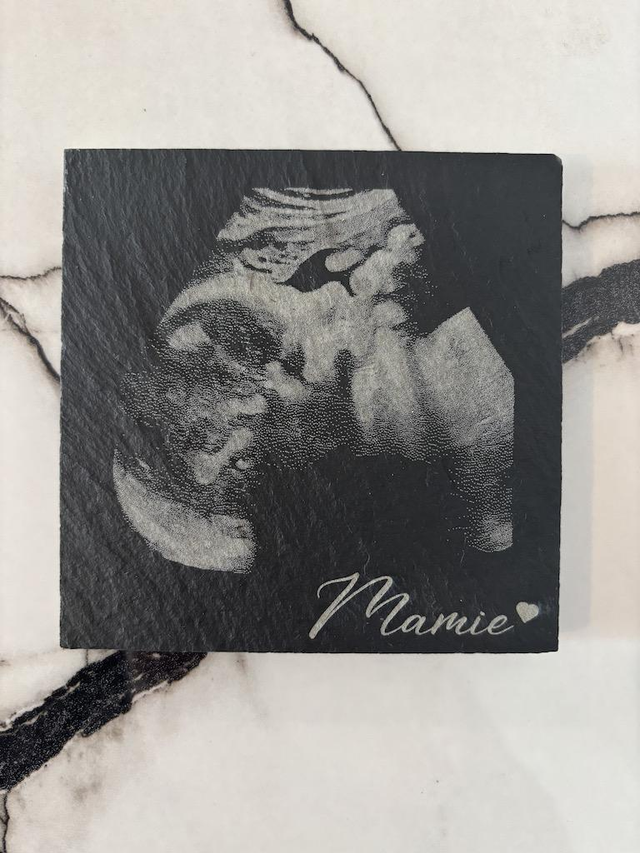 Echographie gravé sur un dessous de verre en ardoise 10 x 10 cm pour mamie