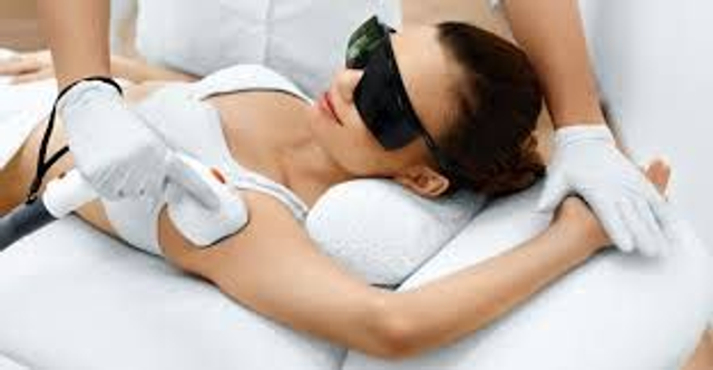EPILAZIONE LASER a zona