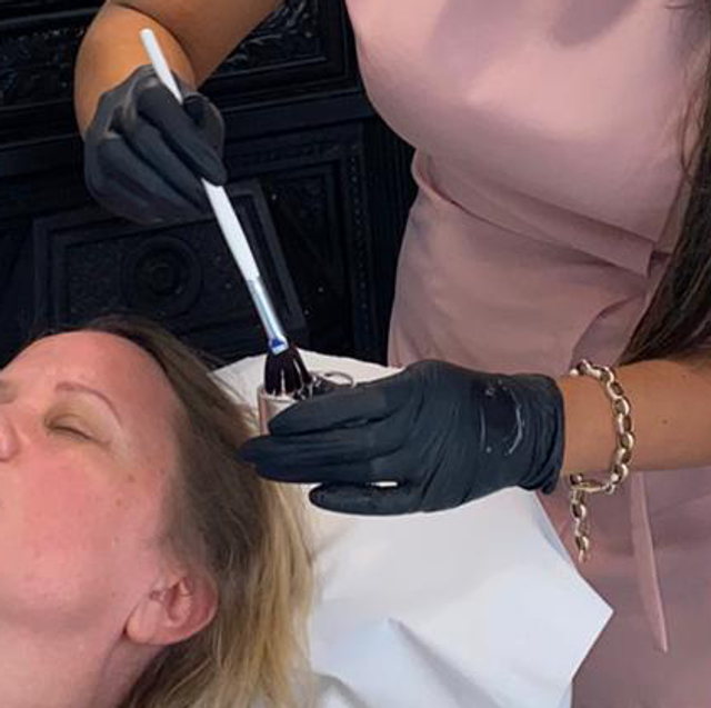 Microneedling with LED light therapy 