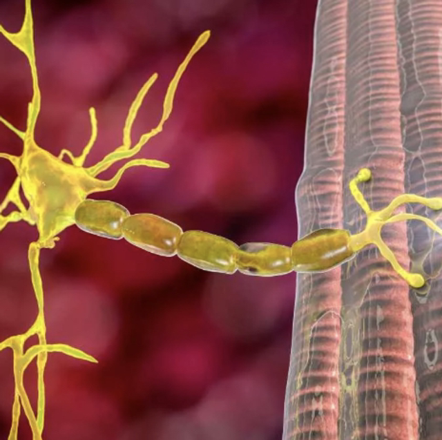 Anticuerpos Miastenia gravis