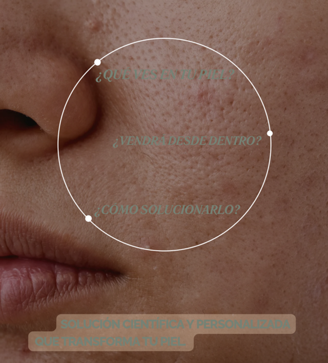 Diagnóstico de piel + terapia facial detox e hidratación + informe de marcadores epigeneticos