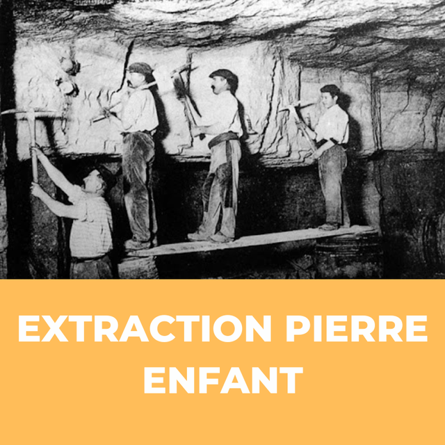 Extraction de la Pierre (Enfant)
