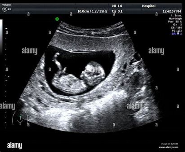 Massage de préconception 60 min 