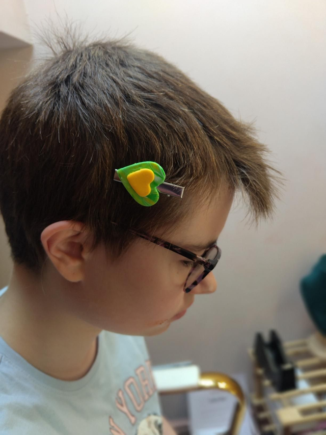 Handmade polymer clay Hair clips set of 2 -Green and yellow 