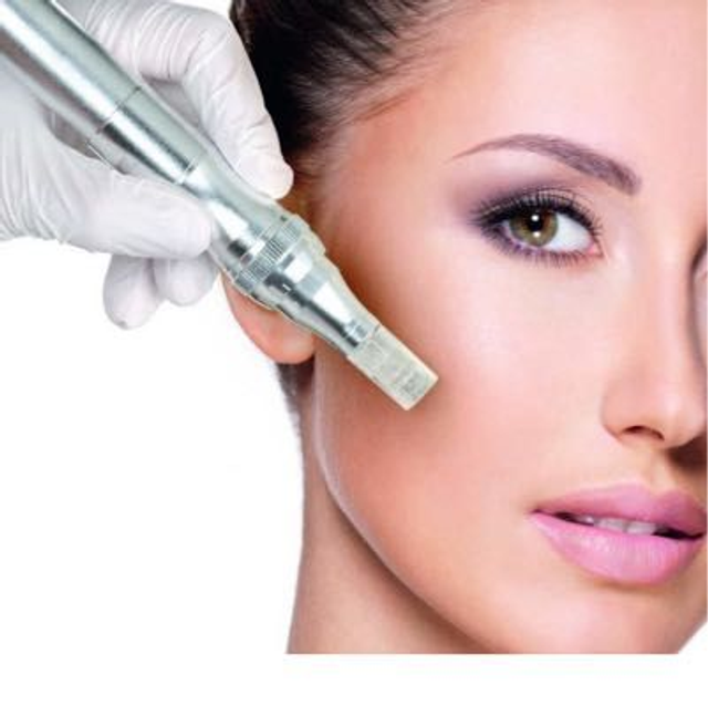 Micro Needling Gesicht 