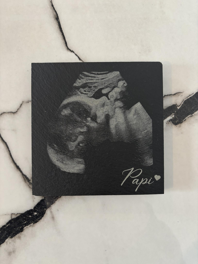 Echographie gravé sur un dessous de verre ardoise 10 x 10 cm pour papi