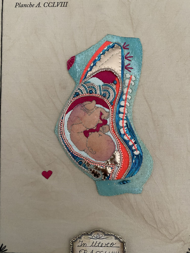 Planche anatomique grossesse bleu et rose fluo